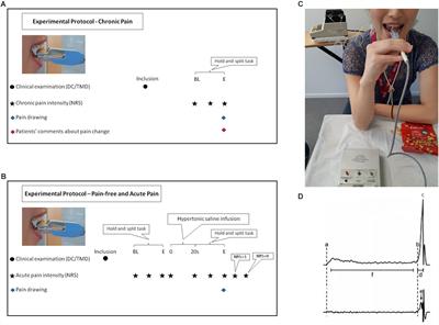 Effects of Chronic and Experimental Acute Masseter Pain on Precision Biting Behavior in Humans